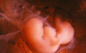 Внутриутробное развитие по неделям беременности
